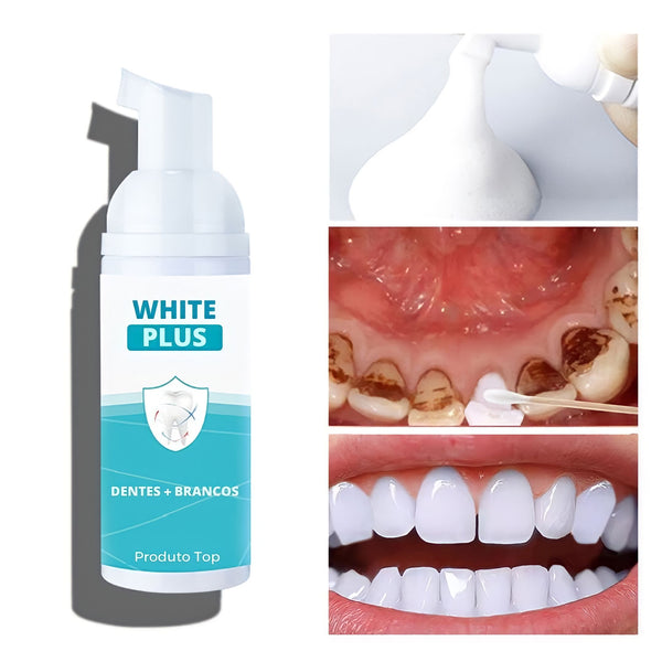 Clareador Dental Instantâneo - White Plus™